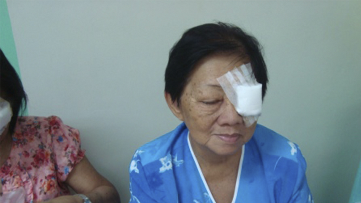 Øjenoperation Juni 2016 Tacloban